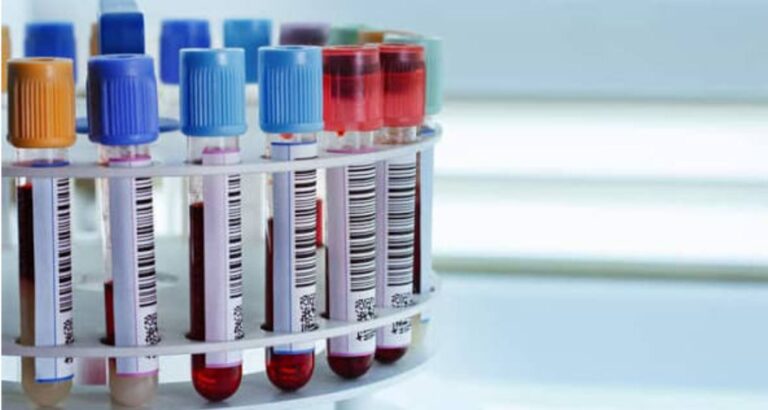 Top Blood Tests Everyone Should Do Once a Year for Better Health