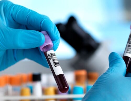Common Diagnostic Tests Before Surgery: Why They Are Important