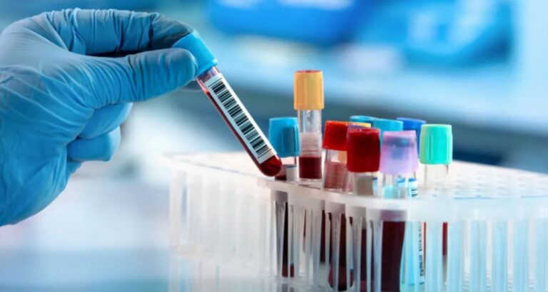 Common Diagnostic Tests Before Surgery: Why They Are Important
