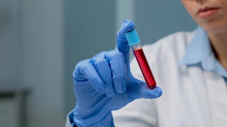 Blood Sample Collection and Testing at Sunrise Diagnostic Centre