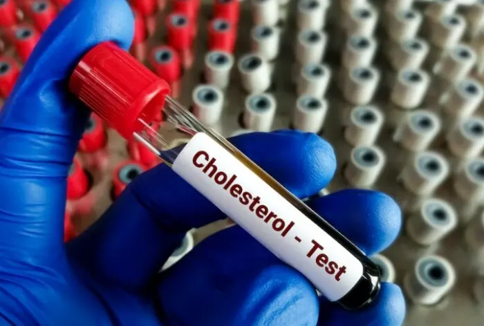 Cholesterol Test