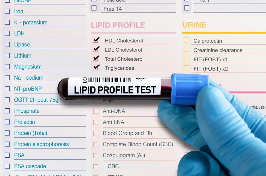Lipid Profile Test