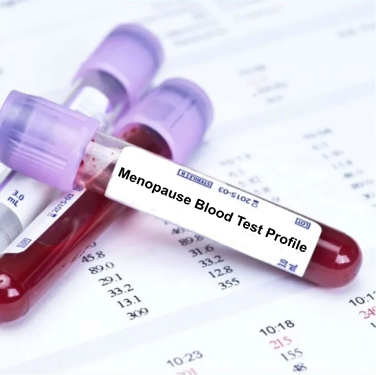 Menopause Health Checkup