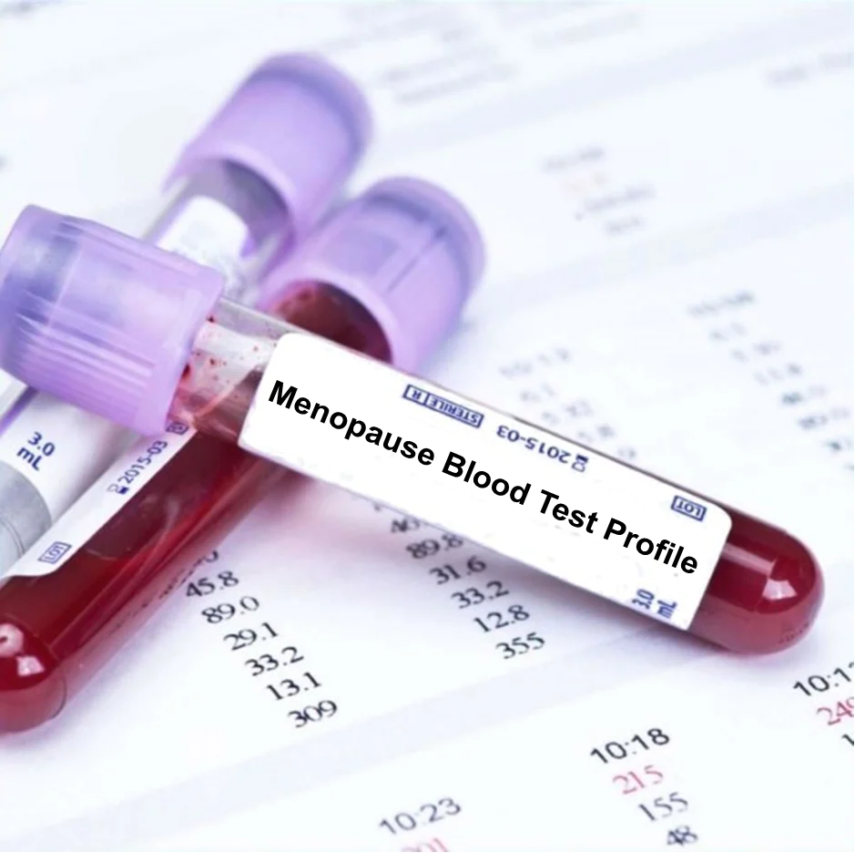 Menopause Health Checkup